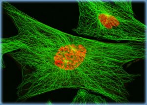 Κυτταροσκελετός από ινίδια ακτίνης (πράσινο). Με ι κόκκινο φαίνετα ο πυρήνας
