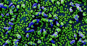 Colorized scanning electron micrograph of a VERO E6 cell (blue) heavily infected with SARS-COV-2 virus particles (green), isolated from a patient sample. Image captured and color-enhanced at the NIAID Integrated Research Facility (IRF) in Fort Detrick, Maryland.NIAID